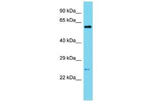 Western Blotting (WB) image for anti-Sperm Associated Antigen 7 (SPAG7) (N-Term) antibody (ABIN2790586) (SPAG7 抗体  (N-Term))