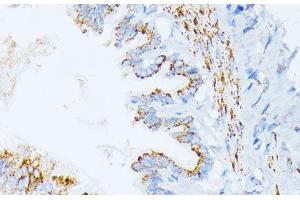 Immunohistochemistry of paraffin-embedded Rat lung using IL3RA Polyclonal Antibody at dilution of 1:100 (40x lens). (IL3RA 抗体)