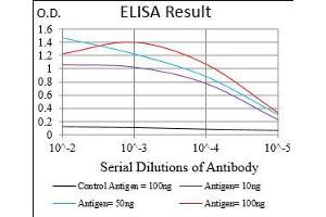 Black line: Control Antigen (100 ng), Purple line: Antigen(10 ng), Blue line: Antigen (50 ng), Red line: Antigen (100 ng), (SMCP 抗体  (AA 1-116))