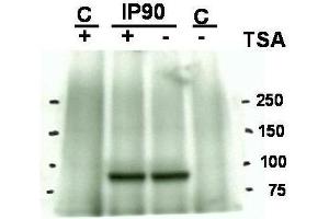 Western blot using  Affinity Purified anti-Hsp90 acetyl K294 antibody shows detection of a band at ~90 kDa corresponding to Hsp90 in an SkBr3 cell lysate (arrowhead) after treatment with Trichostatin A (an HDAC inhibitor). (HSP90 抗体  (Lys294))