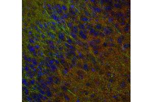 Indirect immunostaining of PFA fixed mouse brain section with anti-synaptogyrin 1 (dilution 1 : 500; red) and mouse anti-MAP 2 (cat. (Synaptogyrin 1 抗体)