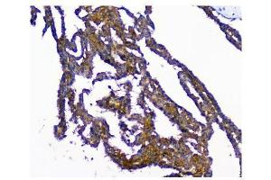 IHC analysis of NMI using anti-NMI antibody (ABIN3043451).