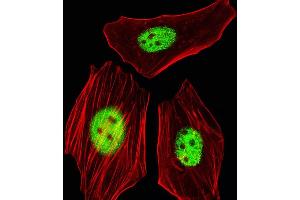 Fluorescent image of HeLa cells stained with AG Antibody (C-term) (ABIN1944739 and ABIN2838563).