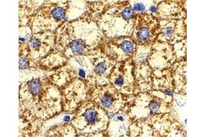 Immunohistochemistry (IHC) image for anti-V-Akt Murine Thymoma Viral Oncogene Homolog 1 (AKT1) (N-Term) antibody (ABIN1031225) (AKT1 抗体  (N-Term))