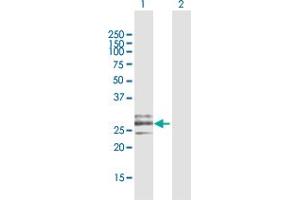 Western Blot analysis of CLEC9A expression in transfected 293T cell line by CLEC9A MaxPab polyclonal antibody.