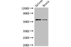 Western Blot Positive WB detected in: Mouse spleen tissue, Mouse brain tissue All lanes: D2HGDH antibody at 3 μg/mL Secondary Goat polyclonal to rabbit IgG at 1/50000 dilution Predicted band size: 57, 33, 35 kDa Observed band size: 57 kDa (D2HGDH 抗体  (AA 14-521))