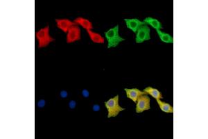ABIN7095992 and ABIN7100054 staining Hela cells by IF/ICC.