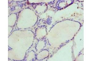 Immunohistochemistry of paraffin-embedded human thyroid tissue using ABIN7155960 at dilution of 1:100 (HAS3 抗体  (AA 339-553))