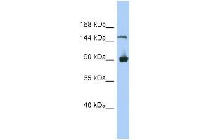 WB Suggested Anti-MGC50722 Antibody Titration: 0. (MGC50722 抗体  (N-Term))