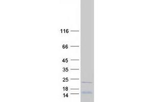 Western Blotting (WB) image for Ribosomal Protein L26-Like 1 (RPL26L1) protein (Myc-DYKDDDDK Tag) (ABIN2731135)