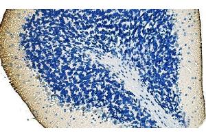 IHC analysis of Ankyrin Erythroid/ANK/ANK1 using anti-Ankyrin Erythroid/ANK/ANK1 antibody (ABIN7599959).
