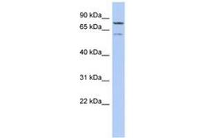 Image no. 1 for anti-Oxidative Stress Induced Growth Inhibitor 1 (OSGIN1) (AA 143-192) antibody (ABIN6743900) (OSGIN1 抗体  (AA 143-192))