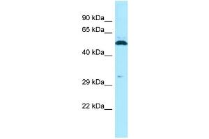 WB Suggested Anti-SPAM1 Antibody Titration: 1. (SPAM1 抗体  (C-Term))