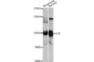 Western blot analysis of extracts of various cell lines, using C1S antibody. (C1S 抗体)