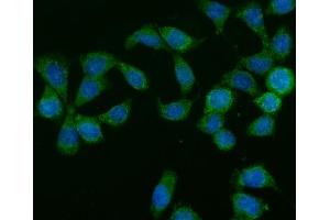 IF analysis of GLB1/Beta-galactosidase using anti-GLB1/Beta-galactosidase antibody (ABIN7601806). (GLB1 抗体  (AA 46-655))