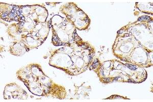 Immunohistochemistry of paraffin-embedded Human placenta using VEGF Receptor 1 Polyclonal Antibody at dilution of 1:100 (40x lens).