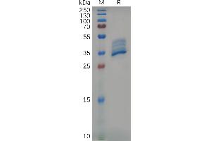 Mouse BCMA Protein, hFc Tag on SDS-PAGE under reducing condition.