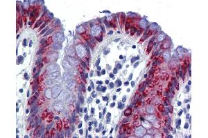 Immunohistochemistry (IHC) image for anti-Anterior Gradient Homolog 2 (Xenopus Laevis) (AGR2) (Middle Region) antibody (ABIN2775338) (AGR2 抗体  (Middle Region))