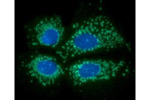 ICC/IF analysis of PDKZ1 in Hep3B cells line, stained with DAPI (Blue) for nucleus staining and monoclonal anti-human PDKZ1 antibody (1:100) with goat anti-mouse IgG-Alexa fluor 488 conjugate (Green). (PDZK1 抗体)