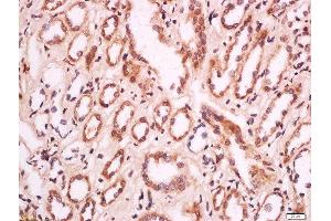 Formalin-fixed and paraffin embedded human kidney labeled with Anti-MELK/HPK38 Polyclonal Antibody, Unconjugated  at 1:200 followed by conjugation to the secondary antibody and DAB staining. (MELK 抗体  (AA 101-250))