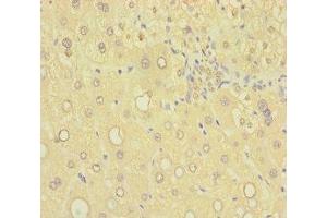 Immunohistochemistry of paraffin-embedded human liver tissue using ABIN7170745 at dilution of 1:100 (SAMD7 抗体  (AA 1-300))