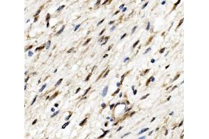 IHC analysis of ETF/TEAD2 using anti-ETF/TEAD2 antibody (ABIN7599879).