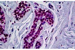 Human Breast: Formalin-Fixed, Paraffin-Embedded (FFPE) (RUNX1 抗体  (AA 210-311))