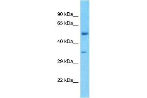 Host:  Rabbit  Target Name:  FBXO2  Sample Tissue:  Human Liver Tumor  Antibody Dilution:  1ug/ml (FBXO2 抗体  (Middle Region))