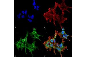 Immunocytochemistry/Immunofluorescence analysis using Mouse Anti-Piccolo Monoclonal Antibody, Clone 6H9-B6 (ABIN863104 and ABIN863105). (Piccolo 抗体)