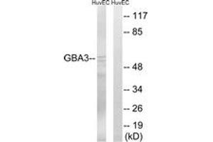 Western blot analysis of extracts from HuvEc cells, using GBA3 Antibody. (GBA3 抗体  (AA 291-340))