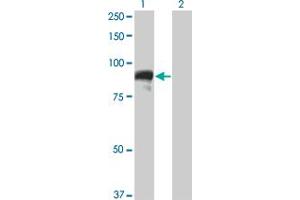 Western Blot analysis of TOP3B expression in transfected 293T cell line by TOP3B monoclonal antibody (M05), clone 4H7. (TOP3B 抗体  (AA 1-862))