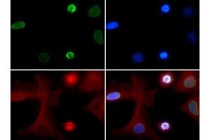 Fluorescence Microscopy (FM) image for anti-Histone H4 (acLys5) antibody (ABIN5706799)