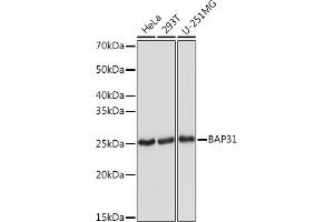 Western blot analysis of extracts of various cell lines, using B Rabbit mAb (ABIN1680181, ABIN7101458, ABIN7101459 and ABIN7101460) at 1:1000 dilution. (BCAP31 抗体)