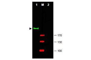 Image no. 1 for anti-GLI Family Zinc Finger 2 (GLI2) (Internal Region) antibody (ABIN401282) (GLI2 抗体  (Internal Region))