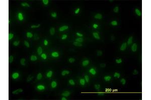 Immunofluorescence of monoclonal antibody to TOP2A on HeLa cell. (Topoisomerase II alpha 抗体  (AA 1435-1531))