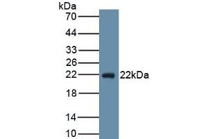Western Blotting (WB) image for anti-Prostaglandin D2 Synthase (PTGDS) (AA 32-190) antibody (ABIN7426007)