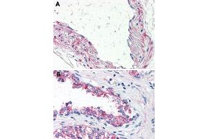 Immunohistochemical staining of formalin-fixed, paraffin-embedded human vessel (A) and human prostate (B) tissue after heat-induced antigen retrieval. (5HT1B Receptor 抗体  (Internal Region))