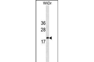 IFNA5 Antibody (C-term) (ABIN1536762 and ABIN2849940) western blot analysis in WiDr cell line lysates (35 μg/lane). (IFNA5 抗体  (C-Term))