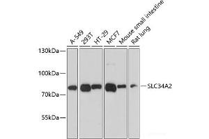 Western blot analysis of extracts of various cell lines using SLC34A2 Polyclonal Antibody at dilution of 1:3000. (SLC34A2 抗体)