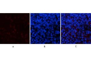 Immunofluorescence analysis of rat spleen tissue. (PPARD 抗体)