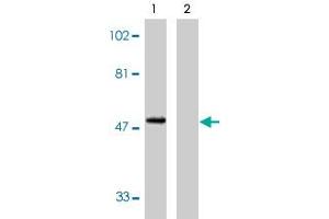 Western blot analysis using CX3CR1 polyclonal antibody at 1 ug/mL on human spleen lysate in the absence (lane 1) and presence (lane 2) of specific blocking peptide. (CX3CR1 抗体  (AA 2-21))