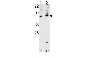 Western blot analysis of VEGF3 Antibody (Center) polyclonal antibody (ABIN388784 and ABIN2839116) (arrow).
