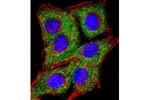 Immunofluorescent analysis of 4% paraformaldehyde-fixed, 0. (TIMP2 抗体)