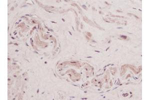 Formalin-Fixed, Paraffin-Embedded Human Sections prostate stained with TSLP Antibody Cat. (Thymic Stromal Lymphopoietin 抗体)
