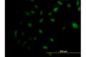 Immunofluorescence of monoclonal antibody to EP300 on HeLa cell. (p300 抗体  (AA 731-830))