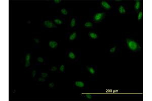 Immunofluorescence of monoclonal antibody to EP300 on HeLa cell. (p300 抗体  (AA 731-830))