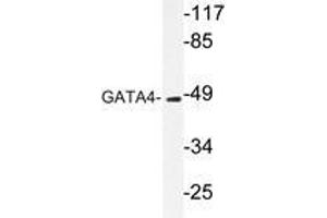 Western blot analysis of GATA4 antibody in extracts from COLO205 cells. (GATA4 抗体)