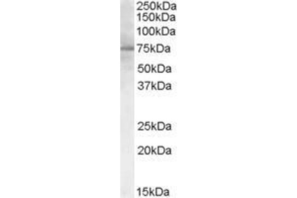 PCSK9 抗体  (C-Term)