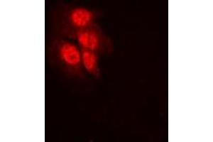 Immunofluorescent analysis of MKK1 (pT292) staining in HeLa cells. (MEK1 抗体  (pSer292))