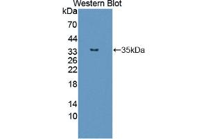 Western blot analysis of the recombinant protein. (TPM3 抗体  (AA 6-248))